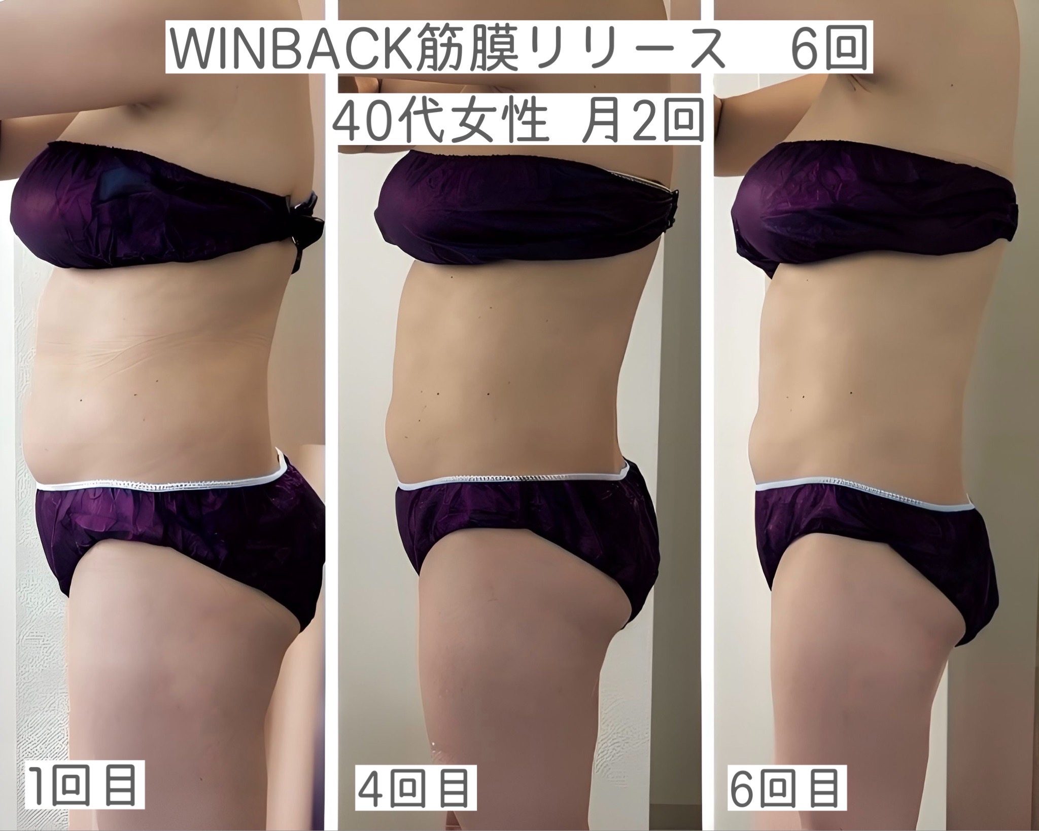 WINBACK×筋膜リリース