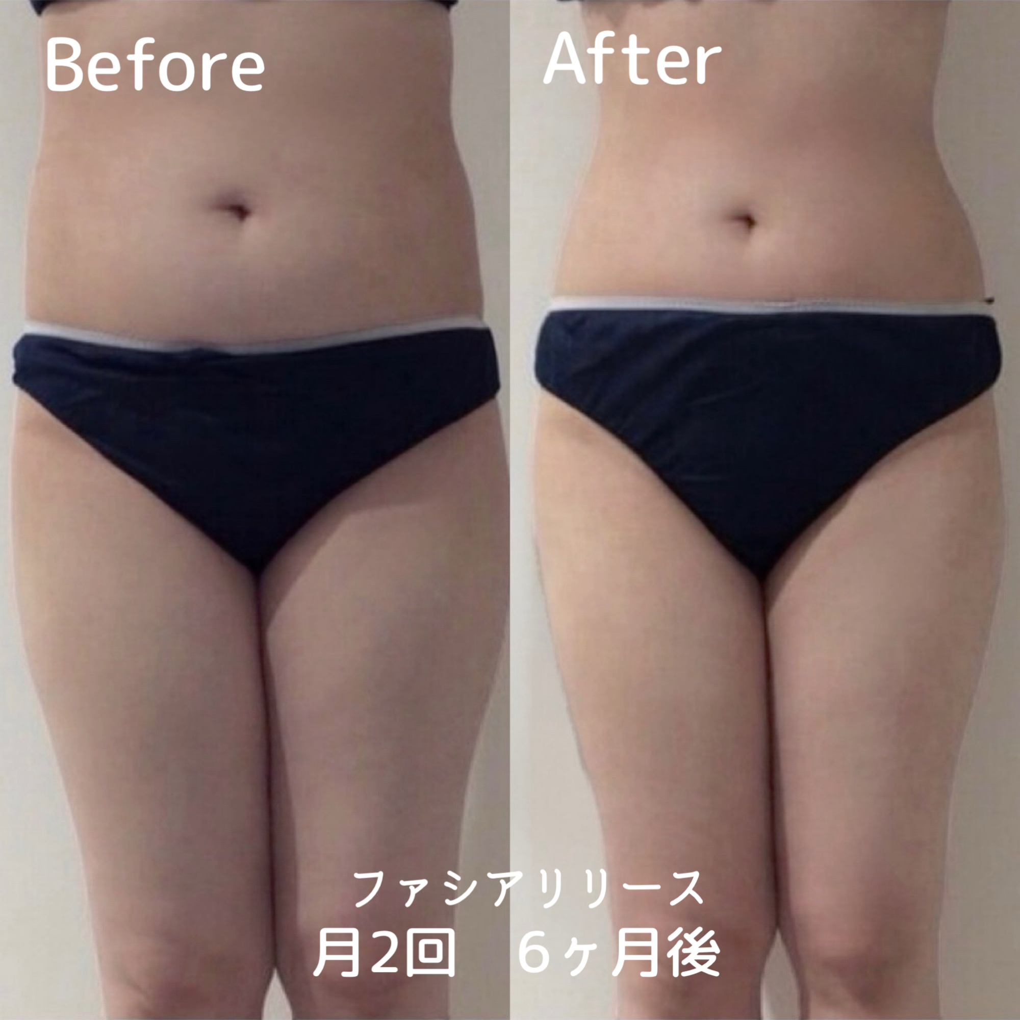 ファシアリリース（下半身痩せ）