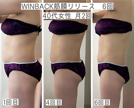 WINBACK×筋膜リリース